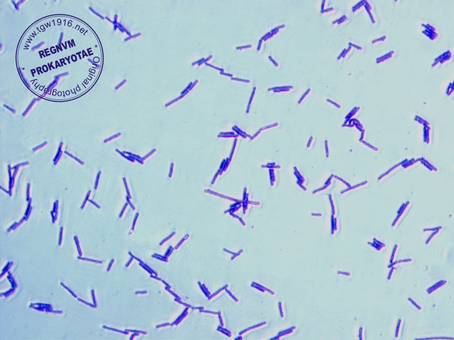 Clostridium Difficile Gram Stain