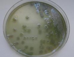 Pseudomonas aeruginosa